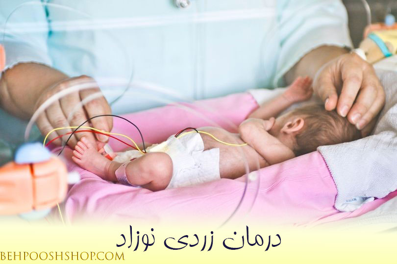 درمان زردی نوزاد