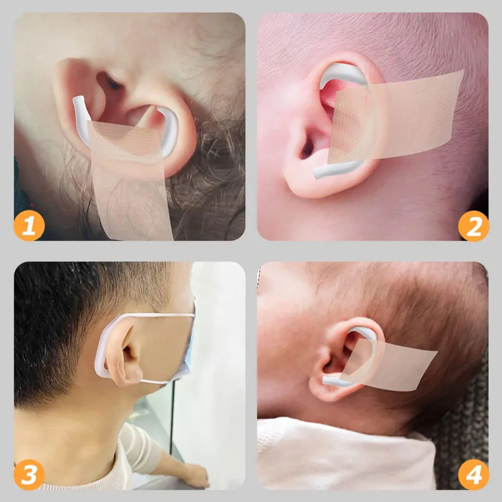 چسب اصلاح گوش نوزاد 4در100 سانت Aike