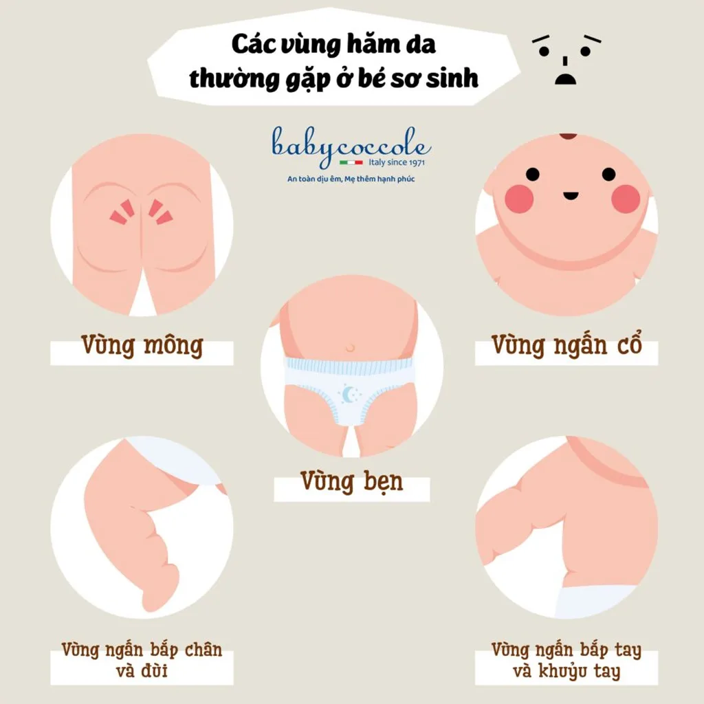 پودر تالک مایع کرم سوختگی 30میل بی بی کوکول Baby coccole