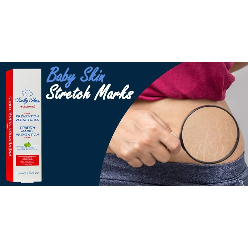 کرم ضد ترک بارداری بیبی اسکین آووکادو باافزایش خاصیت کشسانی 100میل Baby Skin